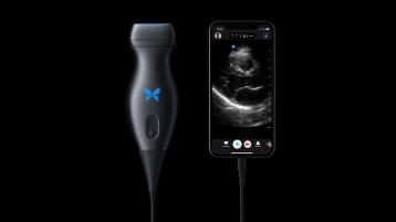 Butterfly iQ: Handheld Ultrasound Tool